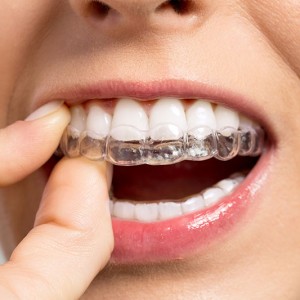 Is zoom teeth whitening painful