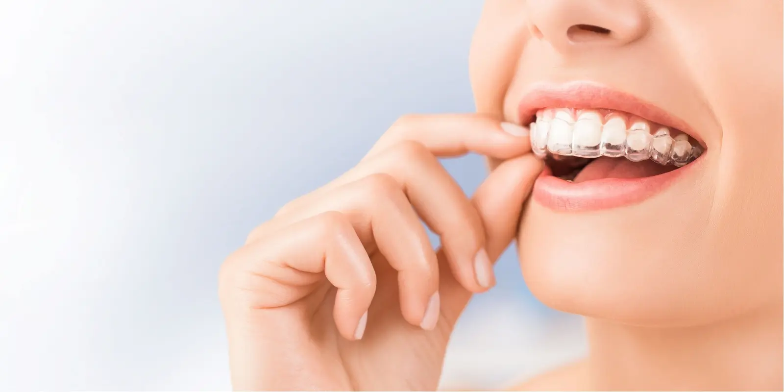 Center City Invisalign - Philly Dentistry