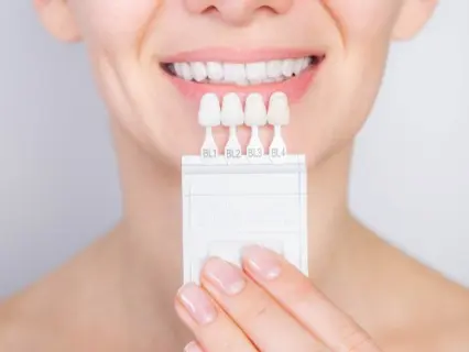 Elements That Affect the Cost of Porcelain Veneers - Philly Dentistry