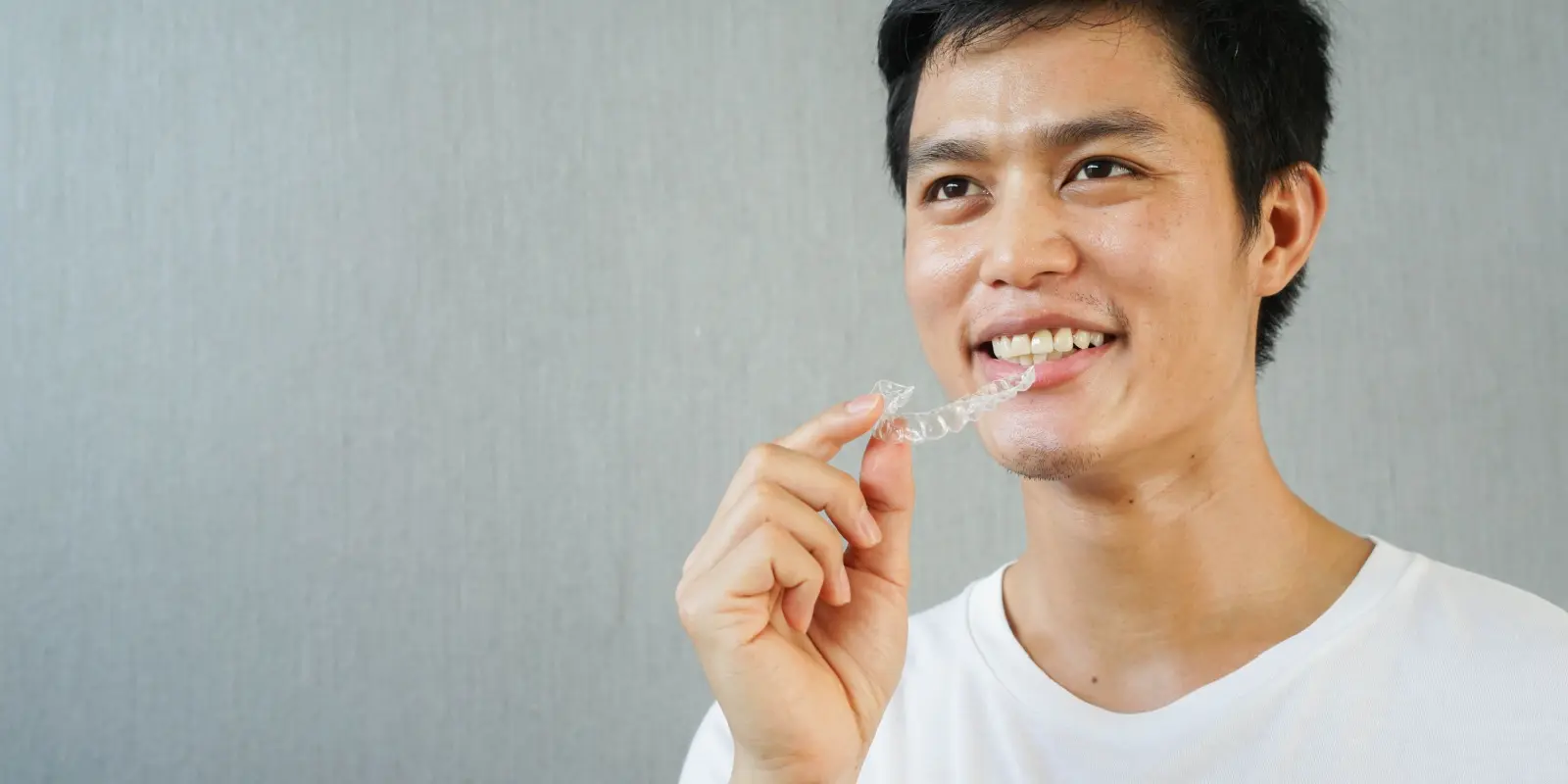 How Does Invisalign Work - Philly Dentistry