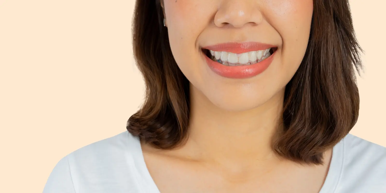 Invisalign for Adults - Philly Dentistry