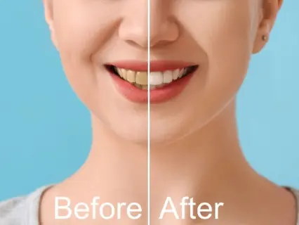 On the Road to a Smile Makeover - Philly Dentistry