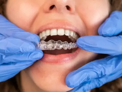 Philadelphia Dentistry_ An Elite Provider of Invisalign