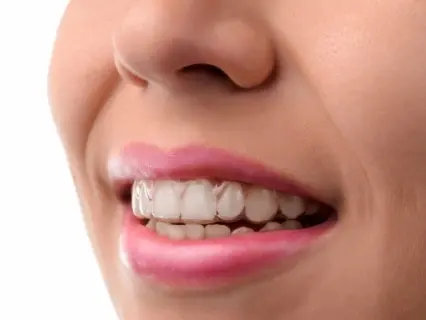 Philadelphia Invisalign Braces_ Priceless -Philly Dentistry