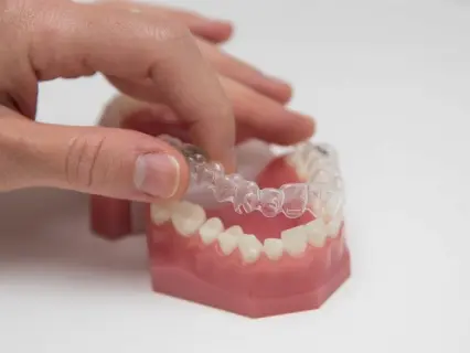 The Way Invisalign Works - Philly Dentistry