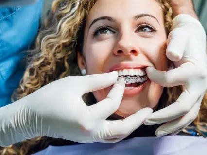 Time Commitment for Invisalign Dental Appointments - Philly Denistry