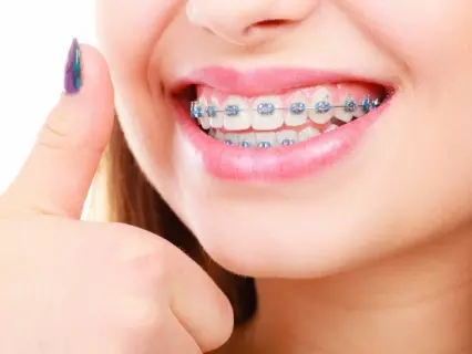 Traditional Metal Braces_ The Sure Thing… Almost - Philly Dentistry