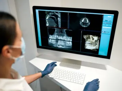 dental xrays