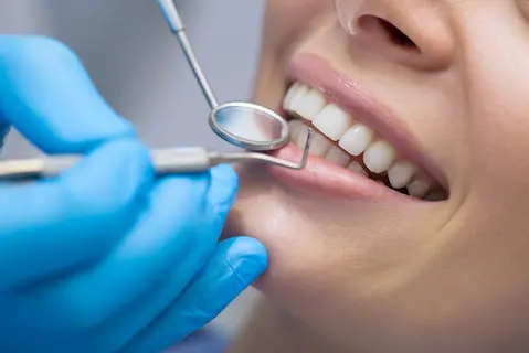 dental implants faq