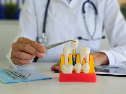 dental implant risks