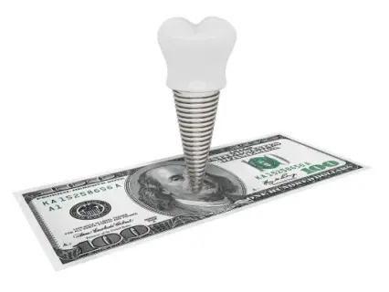 dental implants cost 