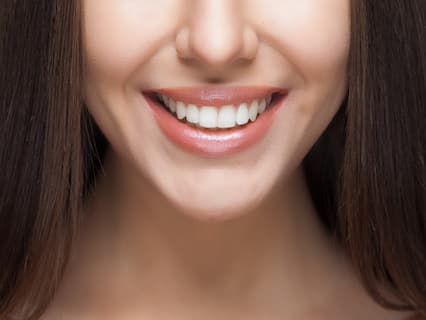 tooth whitening 