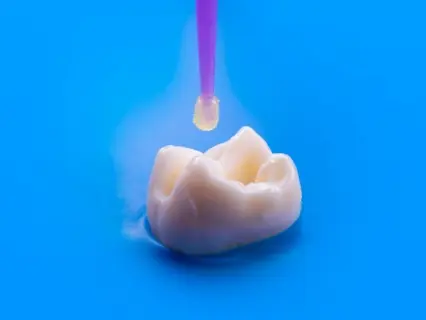 cosmetic tooth bonding